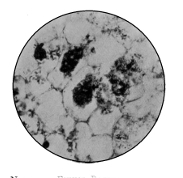 Nitrogen Fixing Bacteria